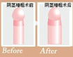 有哪些原因會導(dǎo)致男性陰莖短小